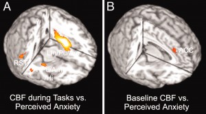 How can we help patients overcome MRI anxiety?