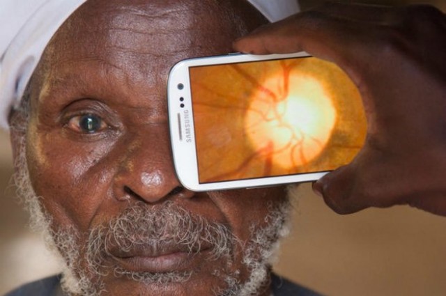 New Device Performs Eye Exams With Smartphone