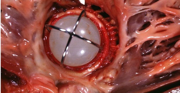 PLAB Review Questions: Quiz 107 - medicalkidunya